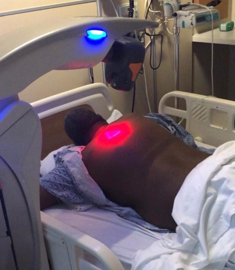 Laser-Treament Laser scanner configuration while the patient is in the prone position with scapular protraction. The laser scanner was adjusted 20 cm above the skin as per manufacturer’s guidelines. The patient is shown here with his hands under his head for maximum scapular protraction. The red light is the laser machine’s guide beam on the skin. Infrared lasers with wavelengths of 808 and 905 nm are not visible to human eyes. The 2 sources are coupled in a single system, the MLS laser system.