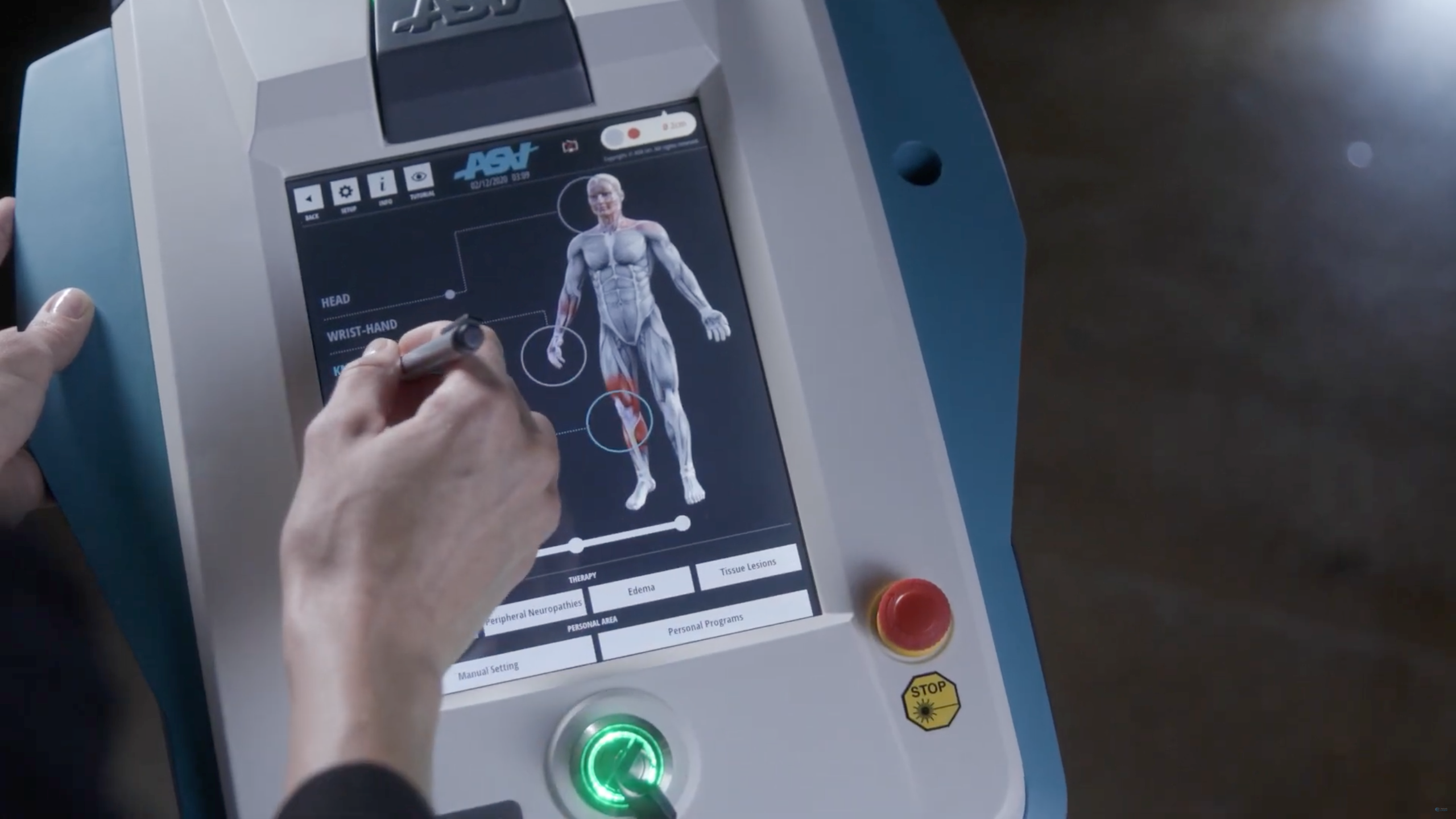 Practitioner using a laser